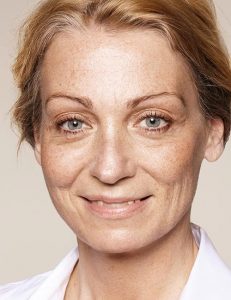 Hautverjüngung bei Tränensäcke Augenfalten und Krähenfüße