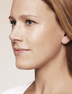 falteununterspritzung, fullface, profil, nachher