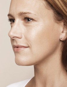 falteununterspritzung, fullface, profil, vorher